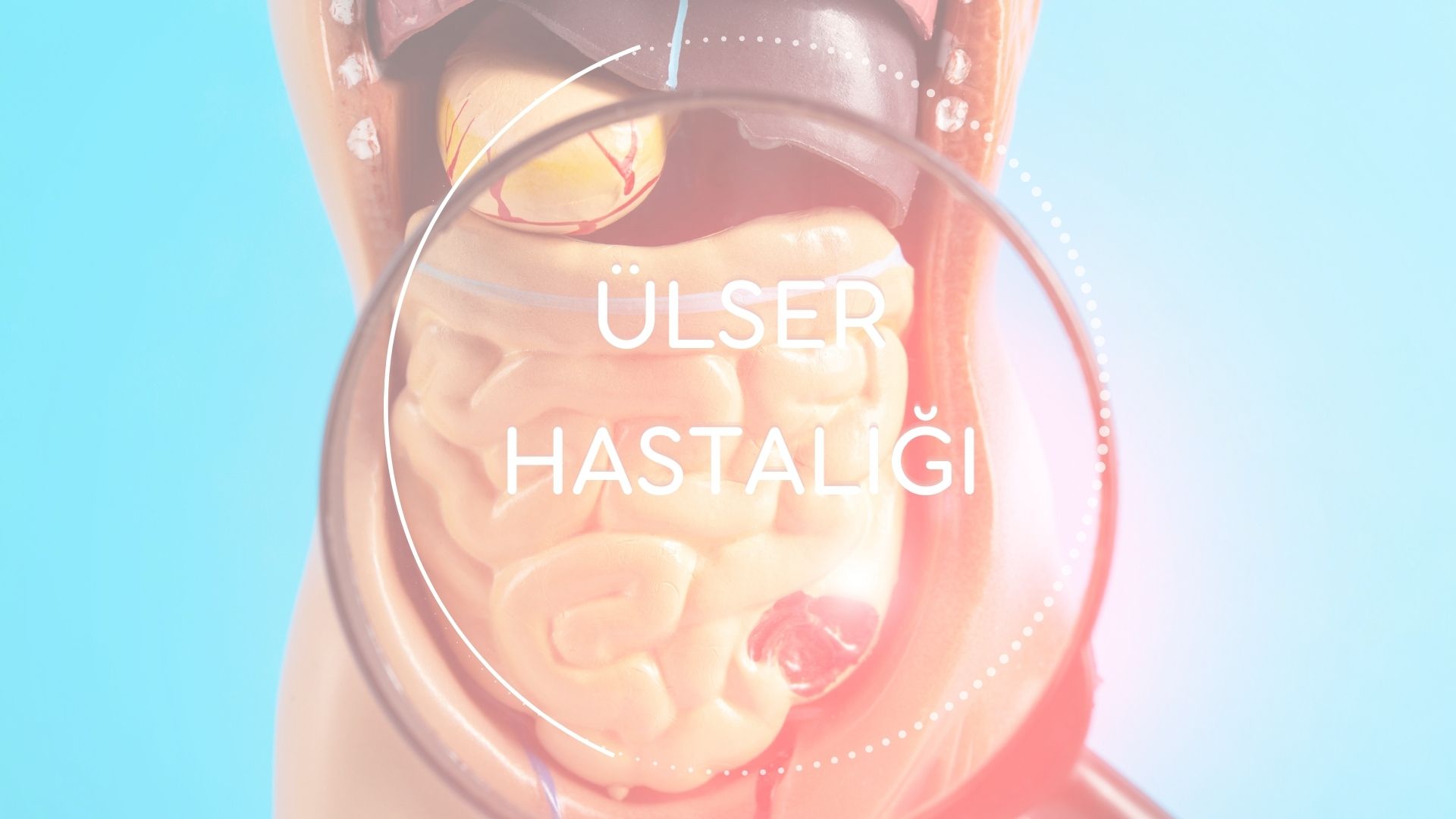 Ülser Hastalığı - Diyetisyen Betül Yolgiden Blog